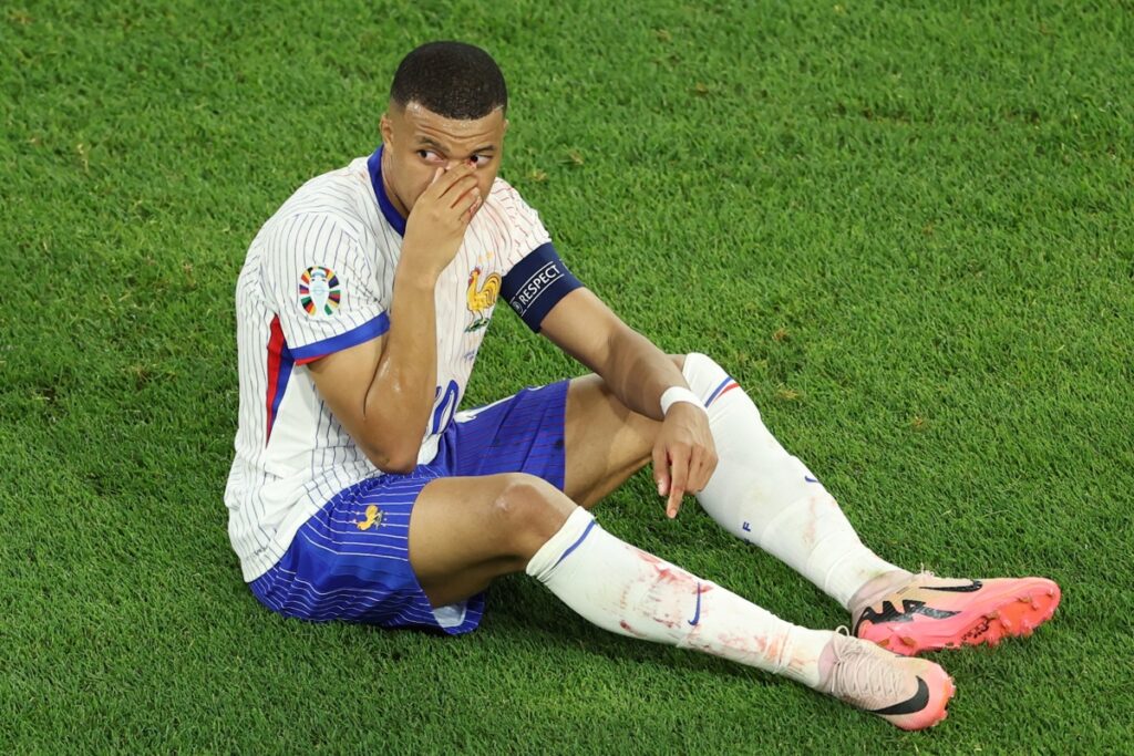 Kylian Mbappé con la Selección de Francia en su último partido en la Eurocopa, donde sufrió una lesión en la nariz.